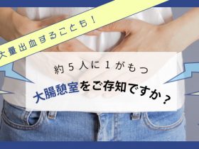 大量出血することも!約5人に1人がもつ大腸憩室をご存知ですか?